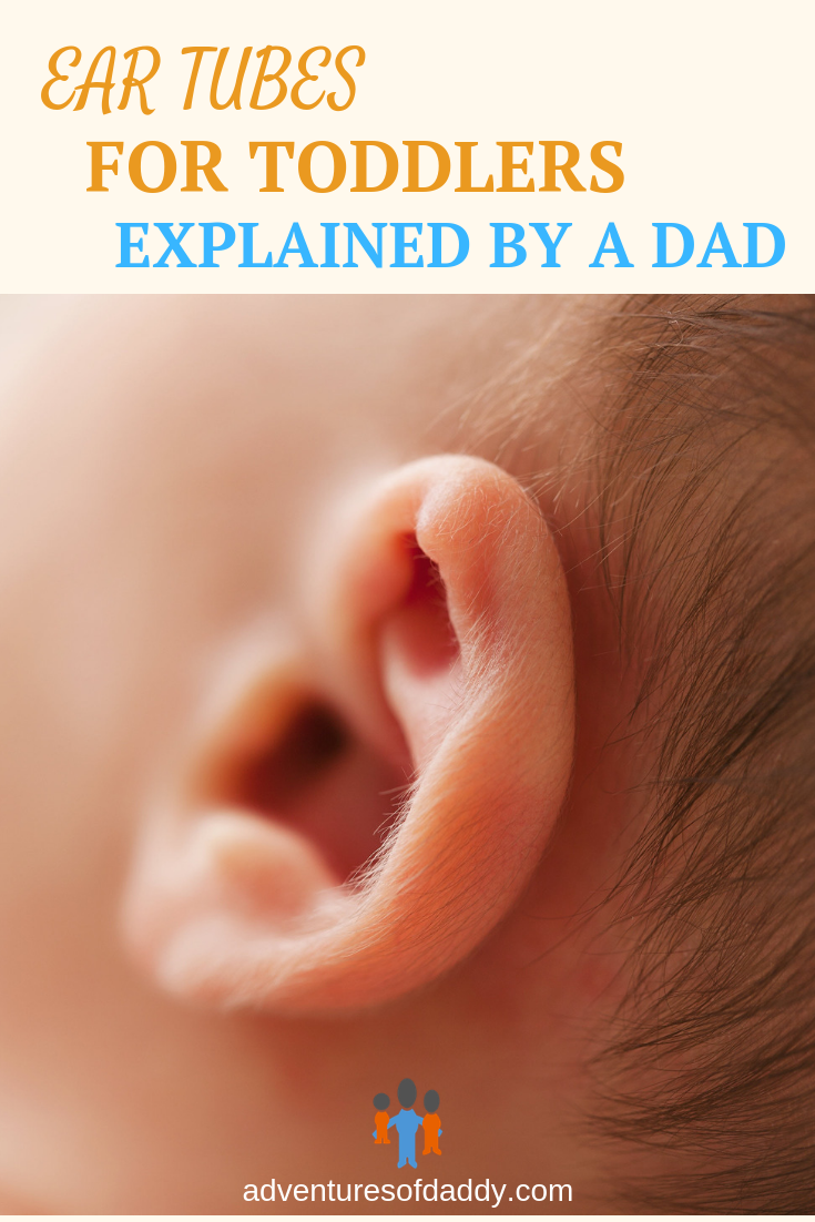 Ear Tubes For Toddlers Explained By A Dad - Adventures of Daddy